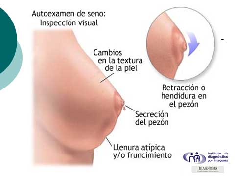 Cncer de mama:un enfoque preventivo y diagnostico temprano